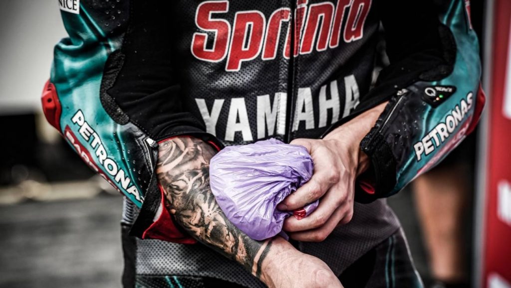 why is arm pump an issue with most motogp riders?